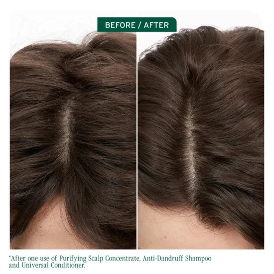 Biolage Scalp Sync Antidandruff Shampoo
