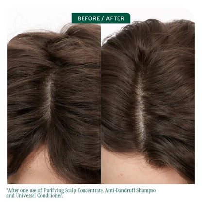 Biolage Scalp Sync Antidandruff Shampoo